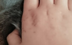 猫に噛まれた　何科　傷　腫れ　治療